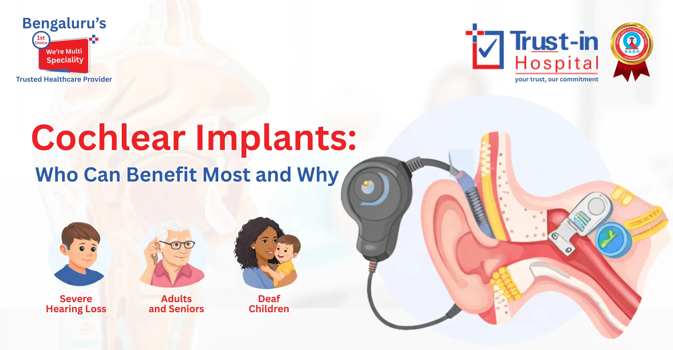Cochlear Implants in Bangalore – Advanced Hearing Solutions | Trust-in Hospital