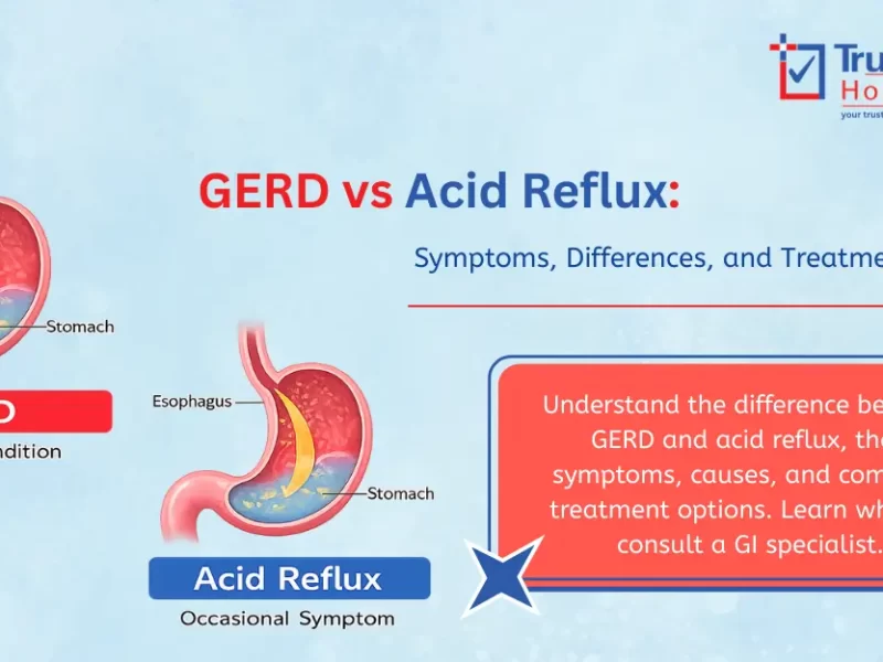 GERD vs Acid Reflux – Know the Difference