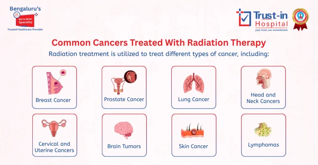 Common Cancers Treated with Radiation Therapy