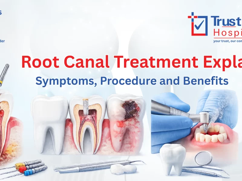 Root Canal Treatment | Trust-In Hospital