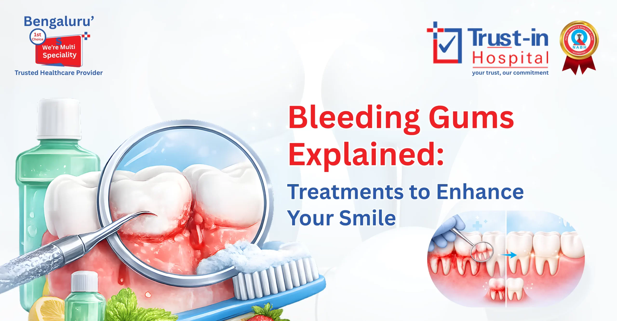 Bleeding Gums Explained: Causes & Treatment | Trust-In Hospital