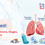 COPD Explained: Causes, Symptoms, Stages & Treatment