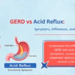 GERD vs Acid Reflux – Know the Difference