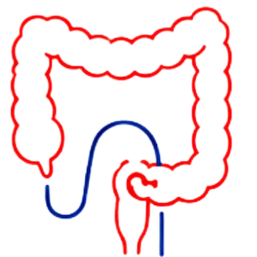 Colonoscopy
