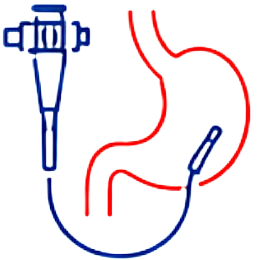 Endoscopy
